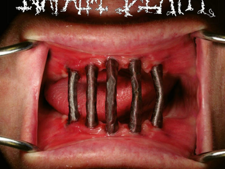 Napalm Death – Coded Smears And More Uncommon Slurs