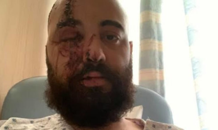 Nervecell, il batterista gravemente ferito nell’esplosione di Beirut